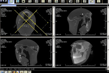 LEADTOOLS Medical Developer Toolkit预览：LEADTOOLS Medical Imaging Developer Toolkit 03
