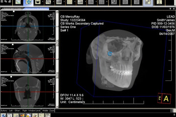 LEADTOOLS Medical Developer Toolkit预览：LEADTOOLS Medical Imaging Developer Toolkit 01