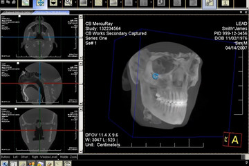 LEADTOOLS Medical Developer Toolkit預(yù)覽：LEADTOOLS Medical Imaging Developer Toolkit 01