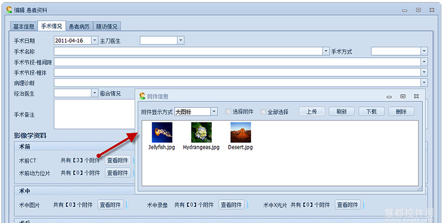 DevExpress GridView使用教程：列表中显示该记录是否包含附件