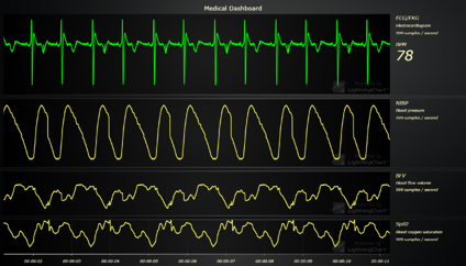 LightningChart在医疗保健领域数据可视化的作用（二）